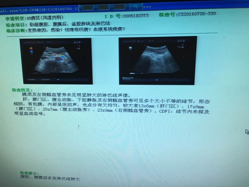 090455vxe3xqwxxqas3mln.jpg