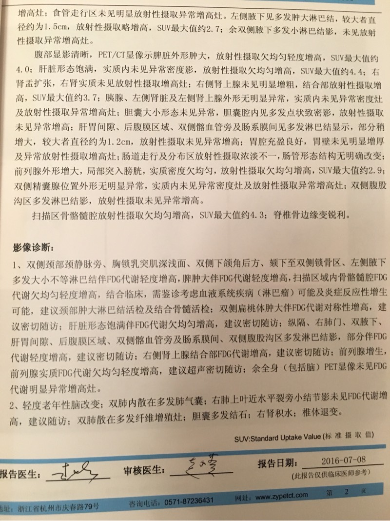 171612ay251xw142xhzhcx.jpg