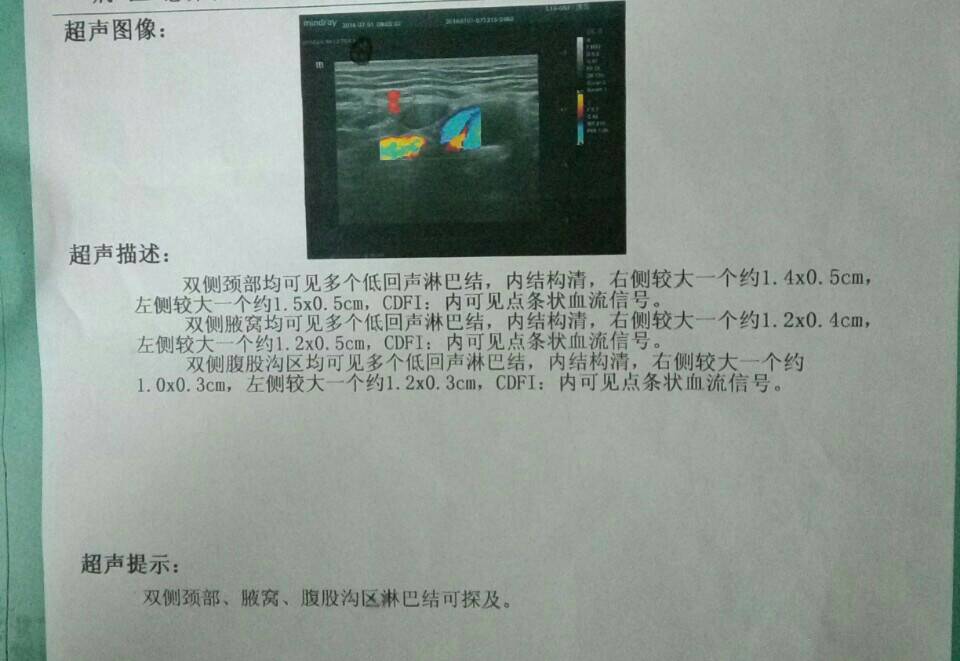 135503dzmhrmpsmh6bmrpp.jpg