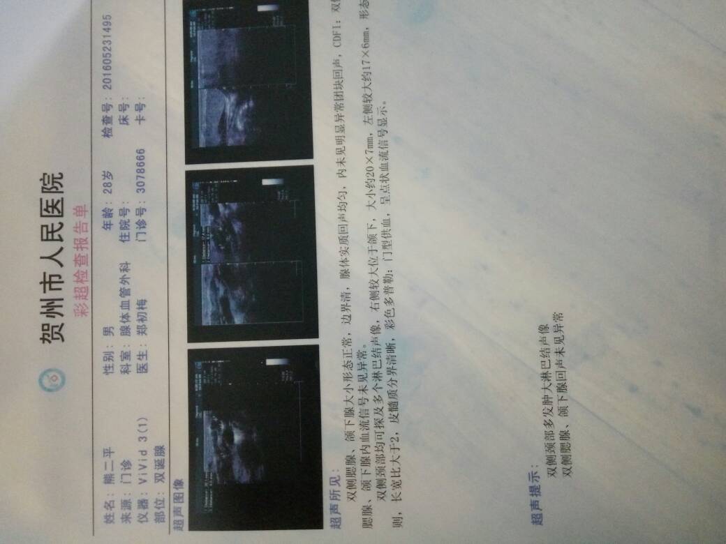 181037ldfkfjra2qfbq257.jpg