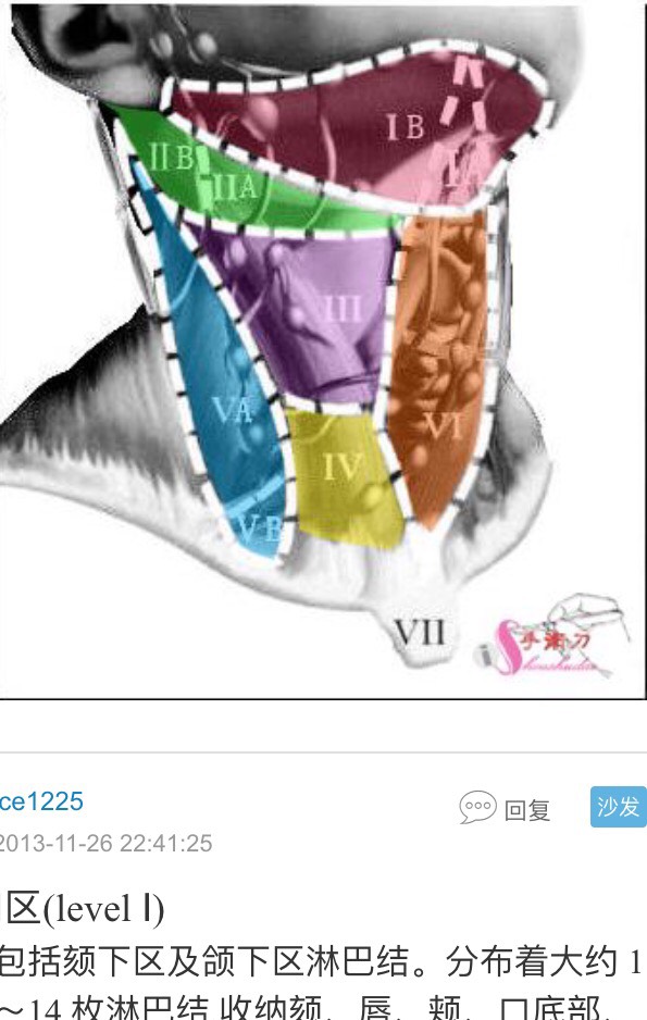 123503rg4yoowyz443uqa3.jpg