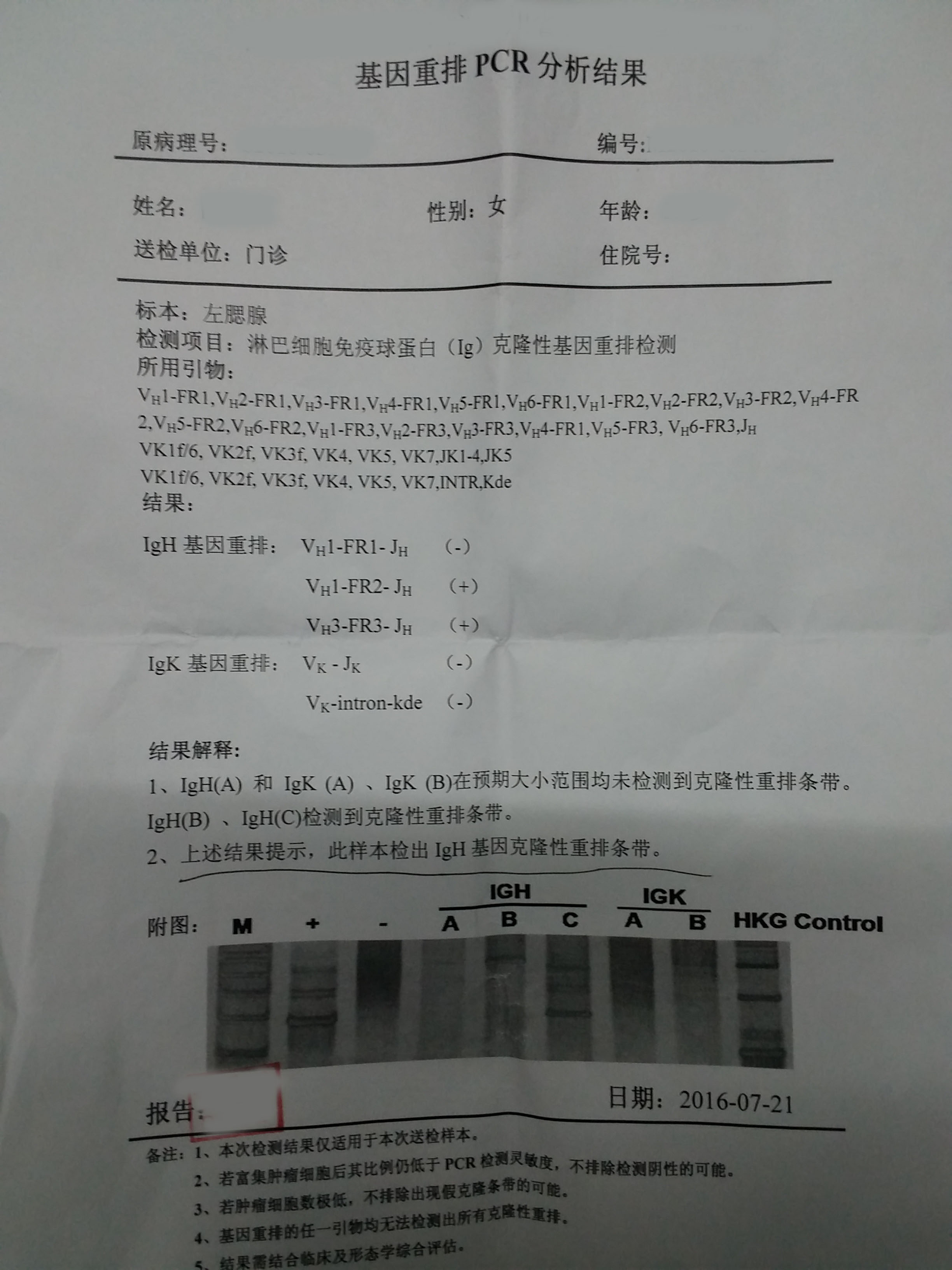 图2 基因重排