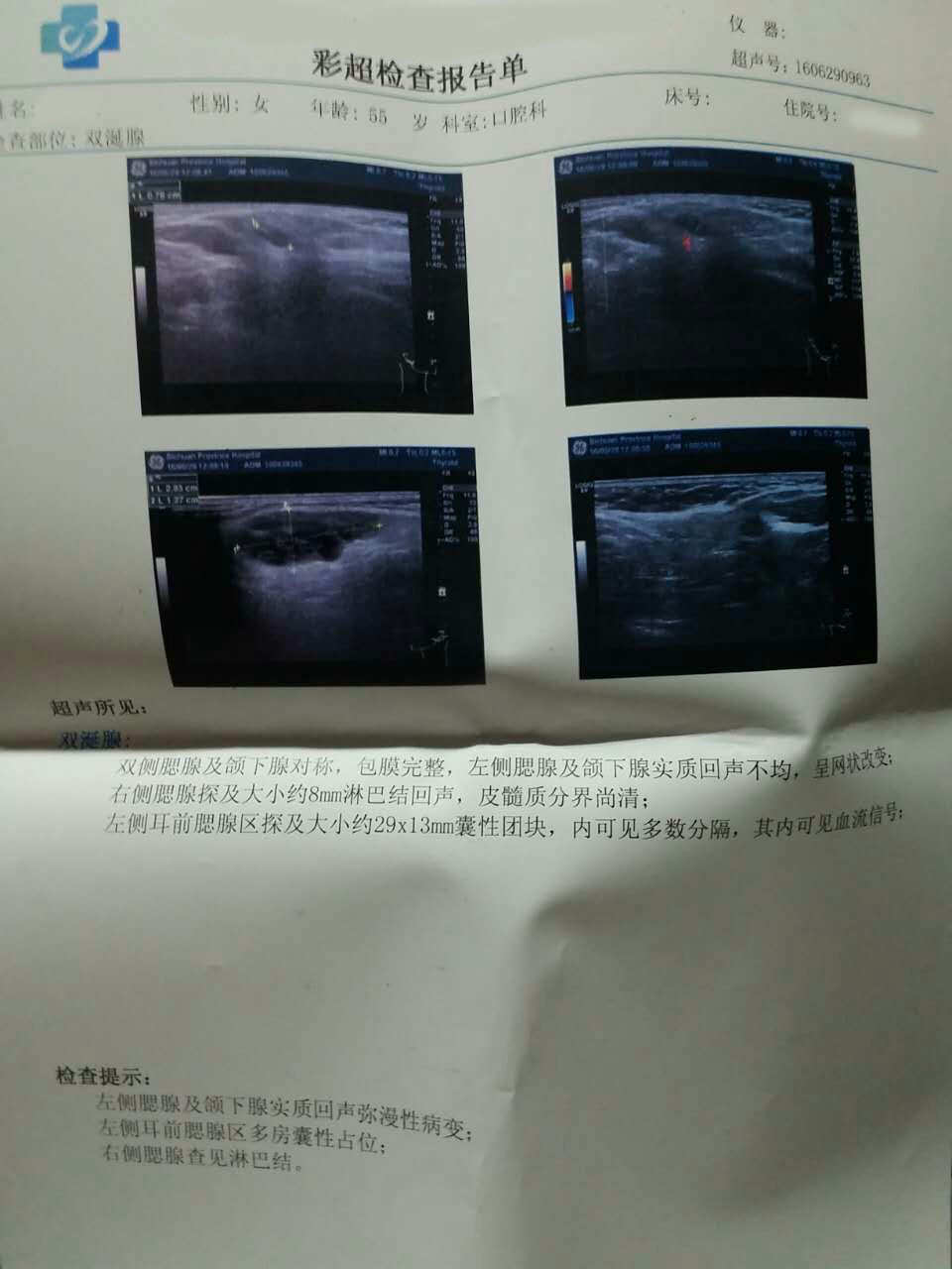 第二次超声