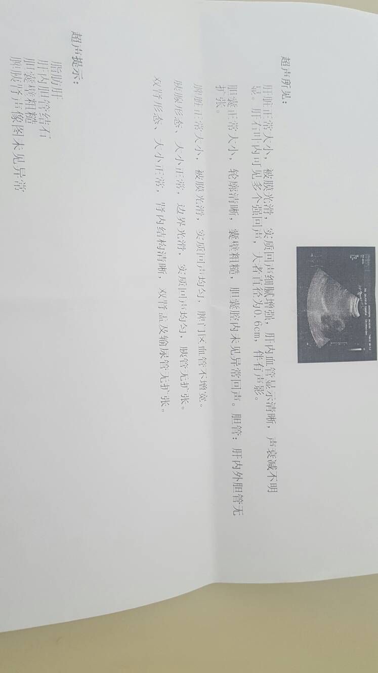 055120bm6evmbidmvvsr99.jpg