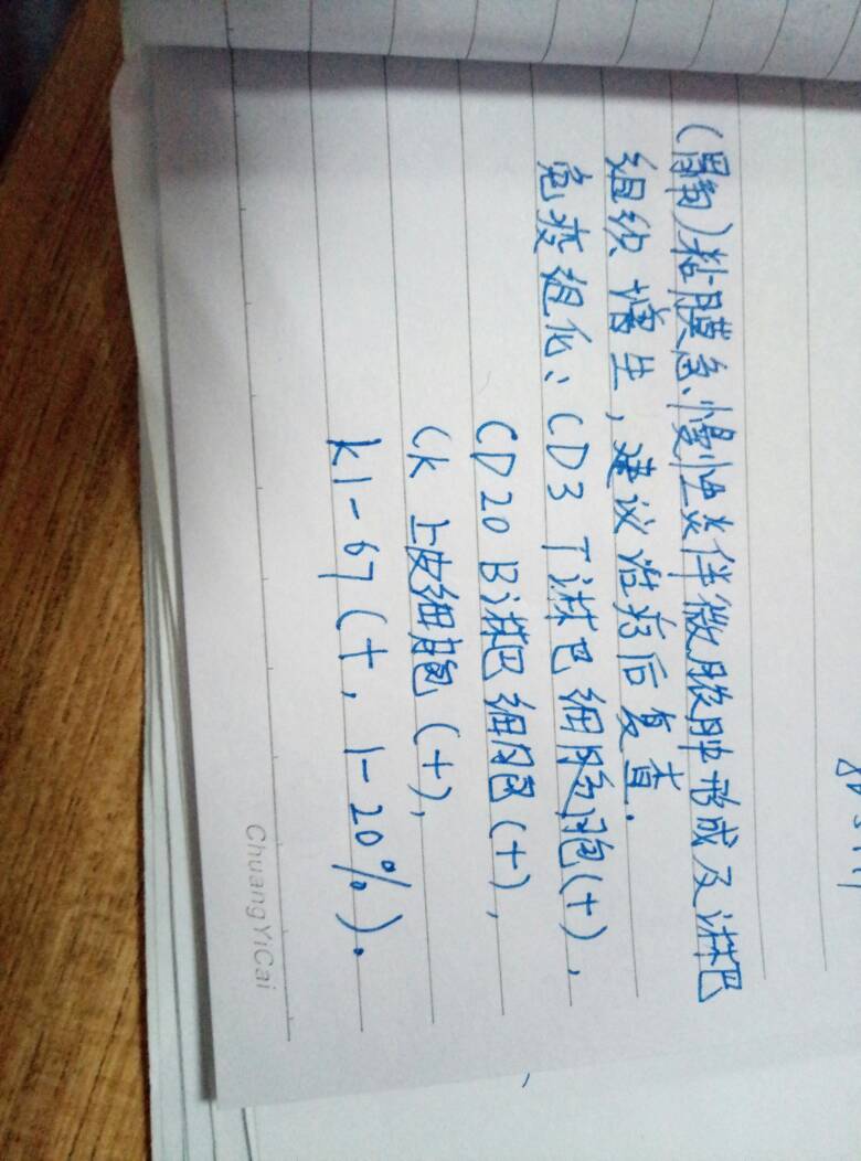 105039fu0kx63i6uuxt2qo.jpg