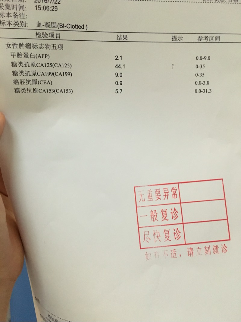 155113kgu3u0e3jt1vk3qe.jpg