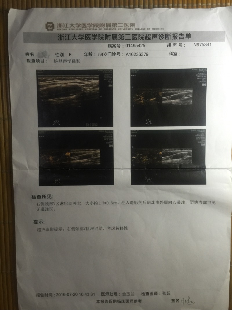 081902xso93lsrzbispvig.jpg