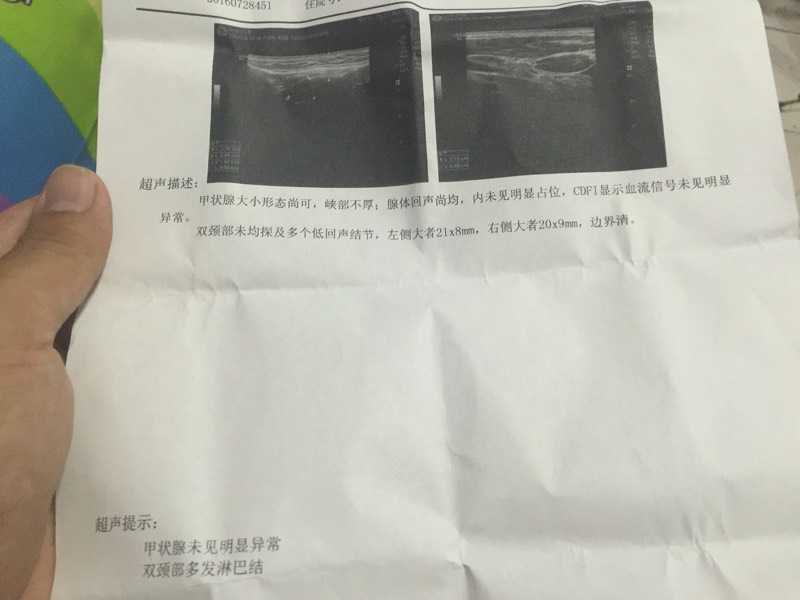 221053wj44t981l4ssmz5s.jpg
