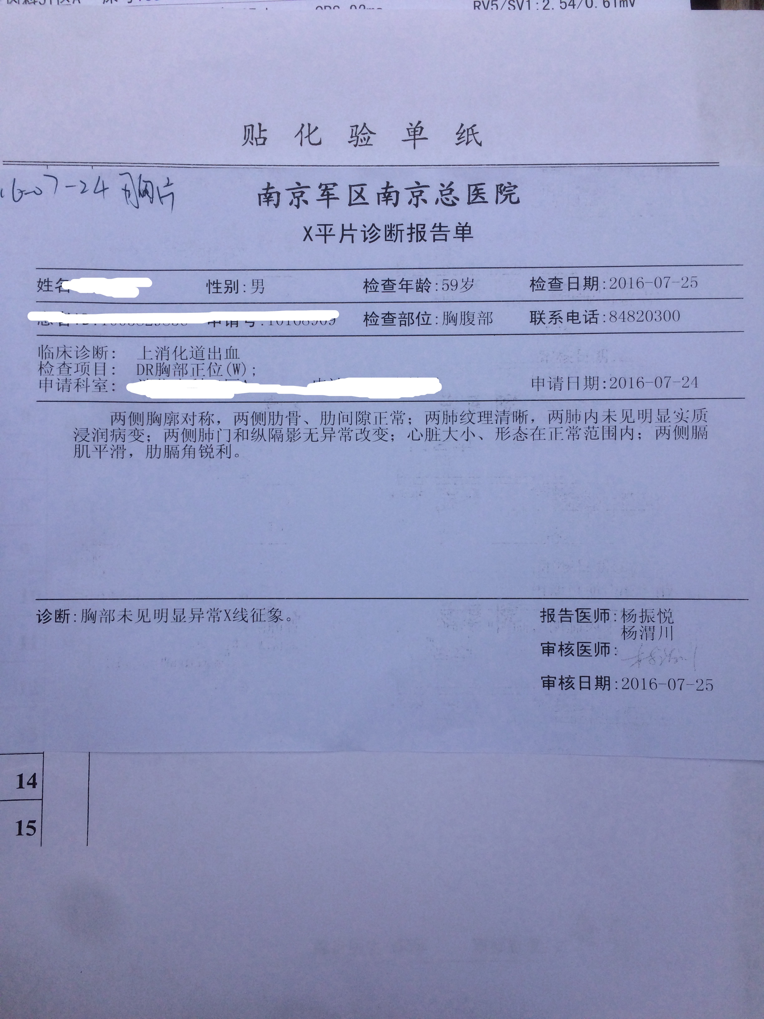 胸片