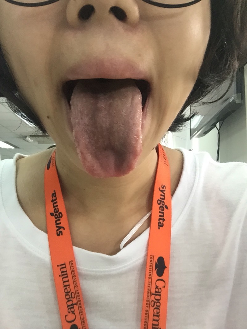 六个月的宝宝舌头发黑_六个月宝宝舌苔黑推拿