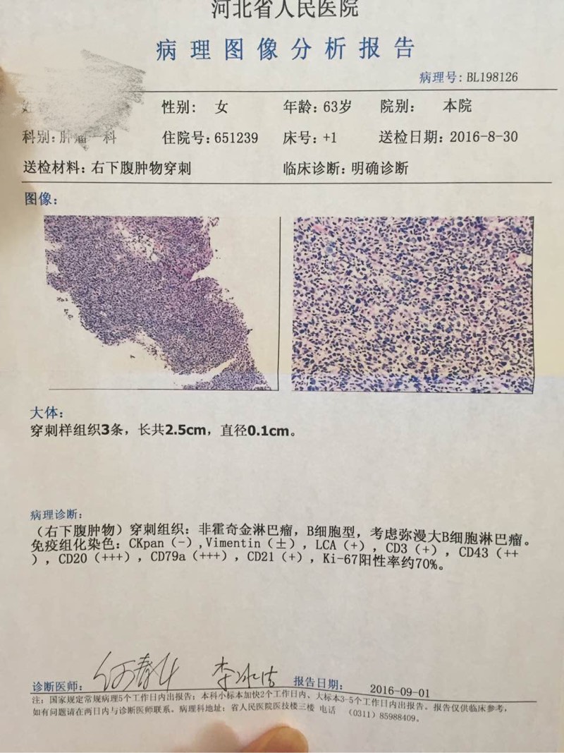 090004a9n5yg1stogyssbi.jpg