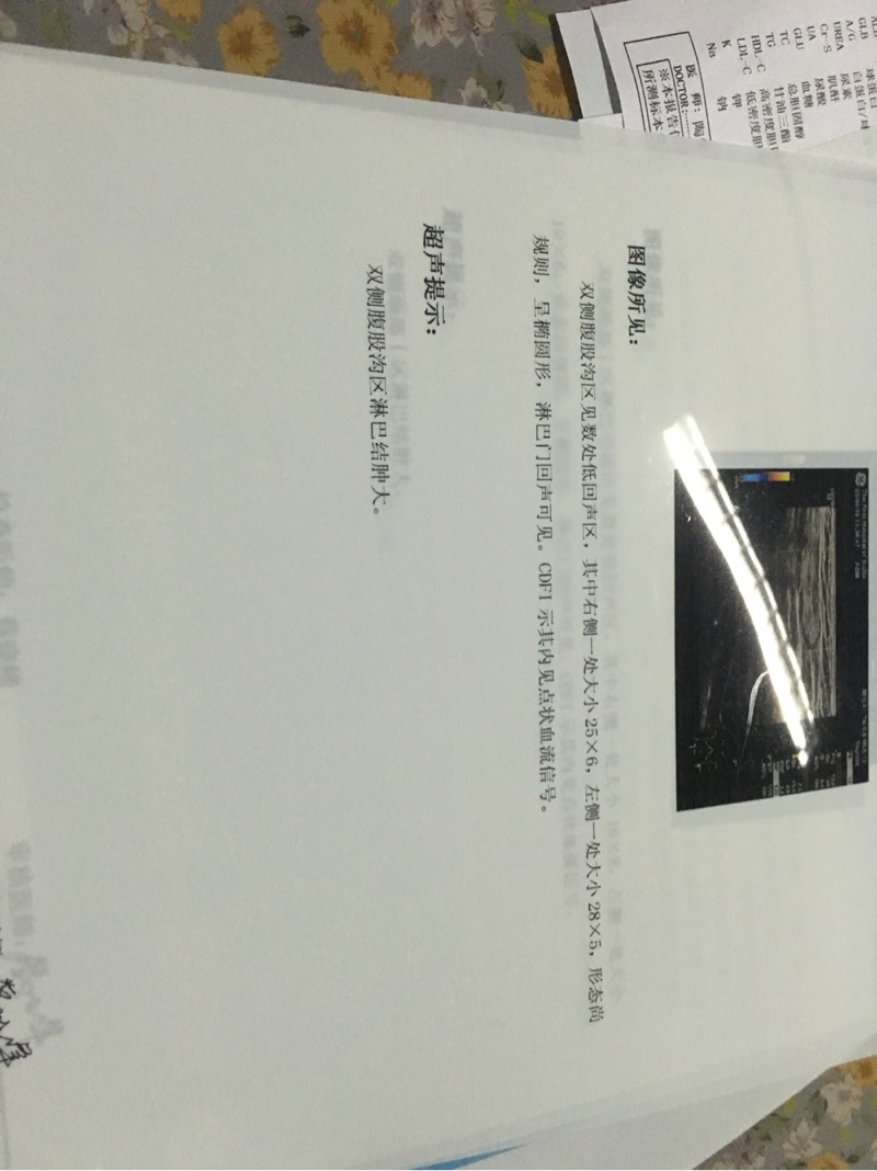 201158j8wto2qqqoj2qtql.jpg