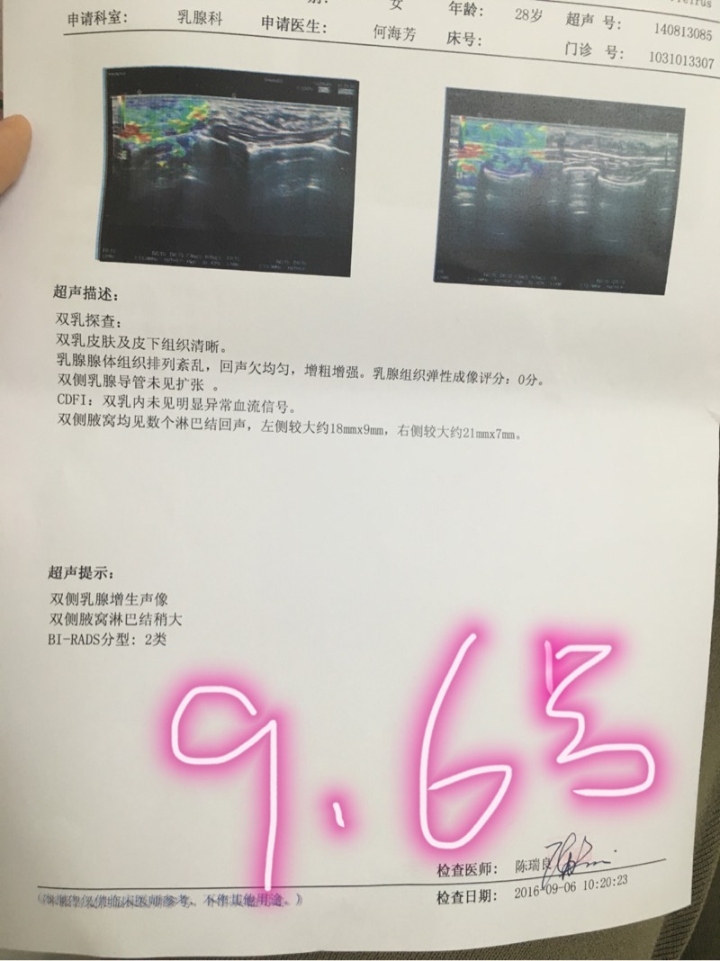 181820se59ks5xa9e7p5xu.jpg