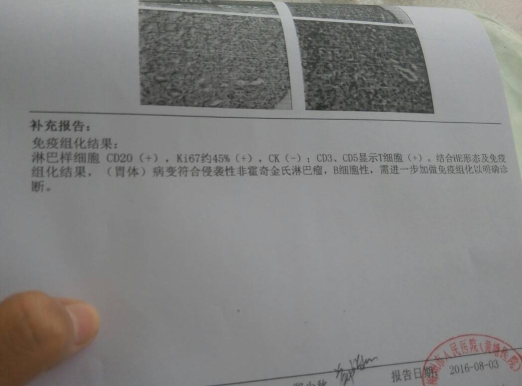 081757rmpplll7193uq2hd.jpg