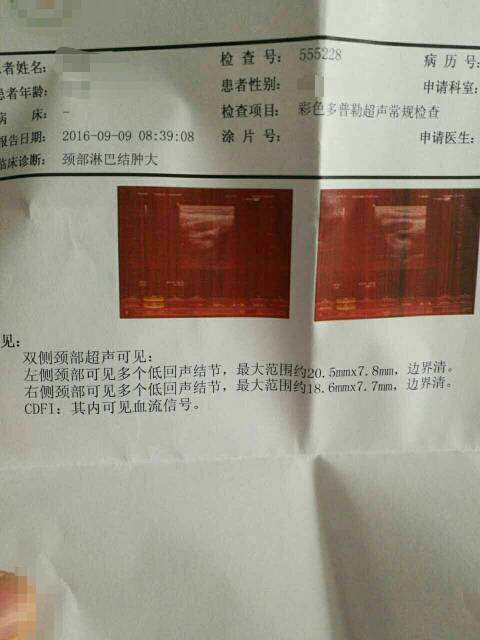 212606oyi7ioxry7on97cr.jpg