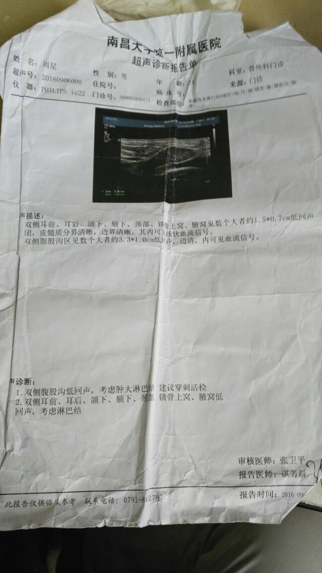 175940nu3ipgh5d8zm5lgp.jpg