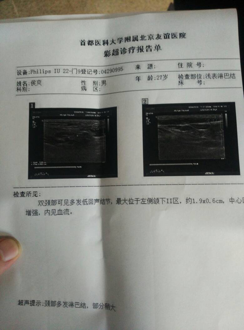 092220tgs6hrhqqteeeyrp.jpg