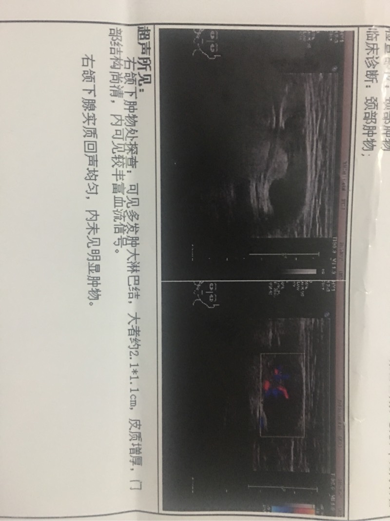 205906s63og4cp2a4ko48c.jpg