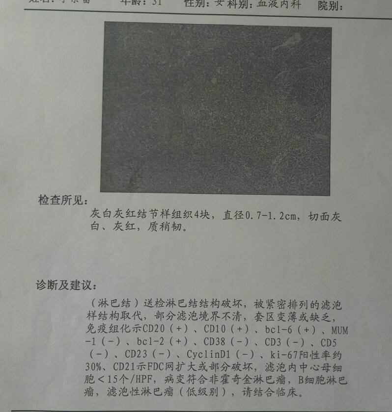 103251ir4f0z4pp3kks0fp.jpg