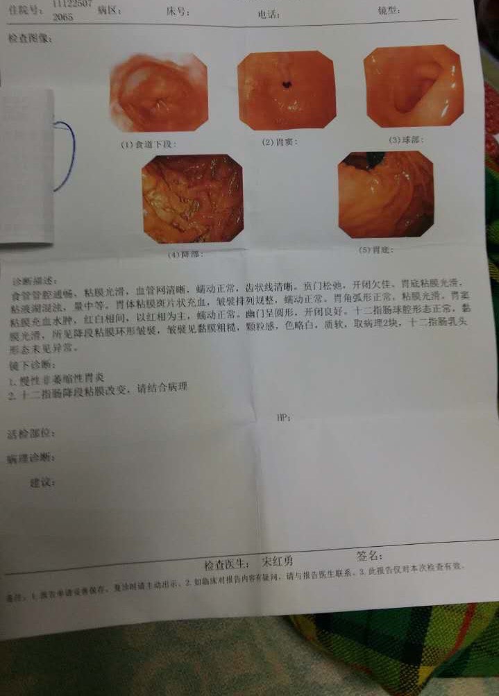 190041p28gesxgzp892hlp.jpg