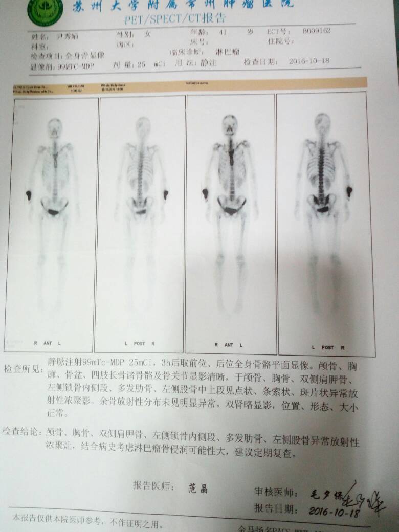 072025uo1zghoh9obhycc5.jpg