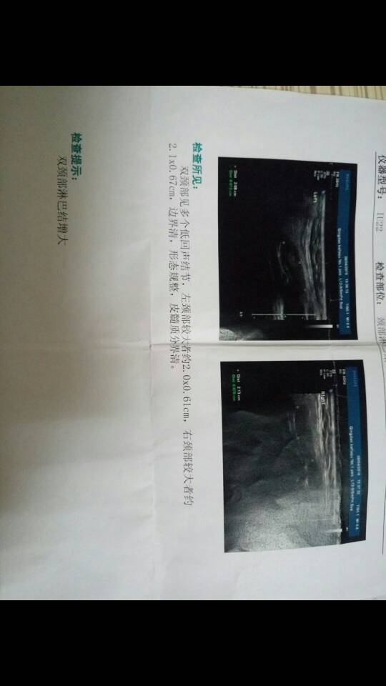 095039fkc7sdm4c64md76o.jpg
