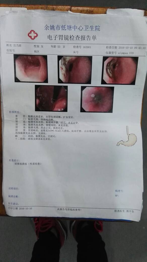 164150xpj155puk31y1qup.jpg