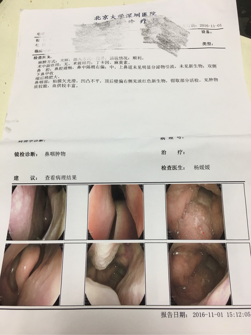 173853g5ohycrru52mch62.jpg