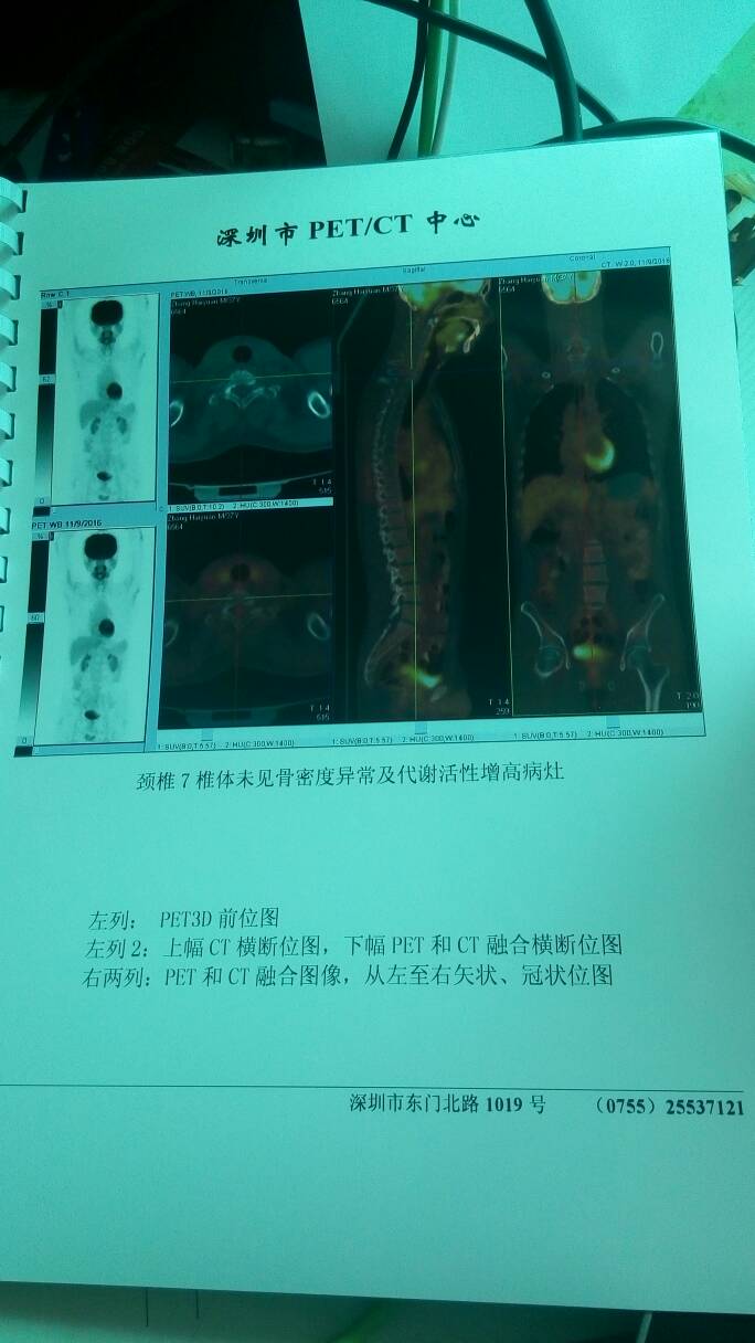 165556tpn8afp1gpp1vqdf.jpg
