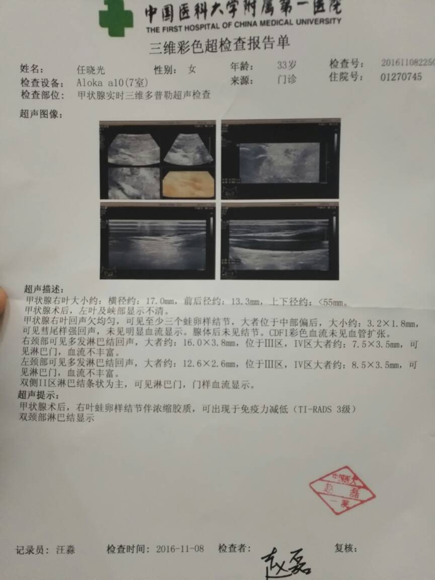 175044s9u0pnh11n82y079.jpg