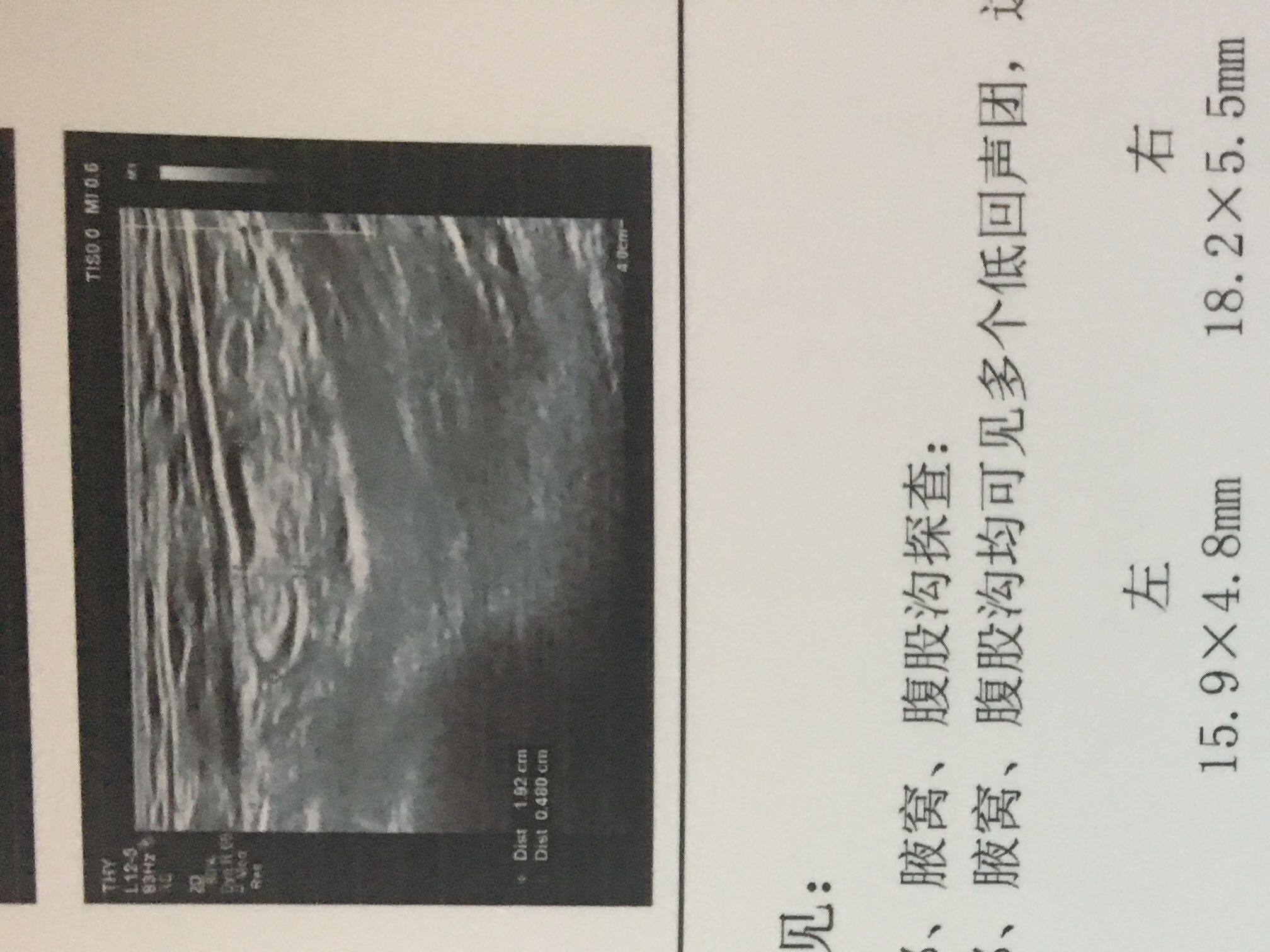 150224pginw3hch5he53d3.JPG