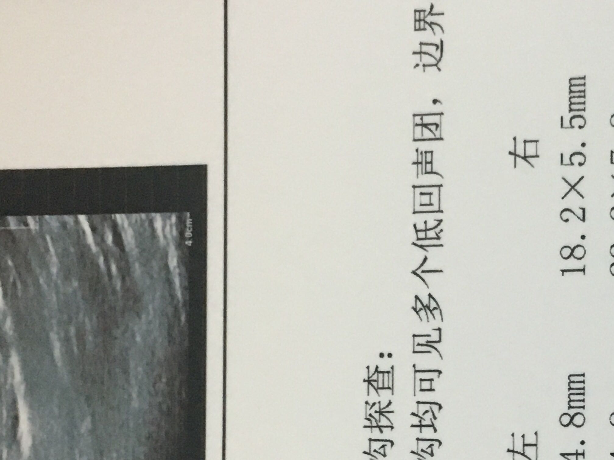 150512r6c7avv5zk46kelp.JPG
