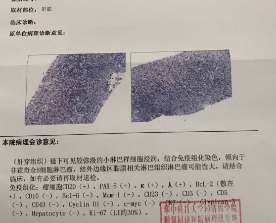 病理报告-11.17.png