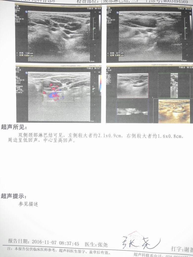 221328q2p0m30pdep9ijji.jpg