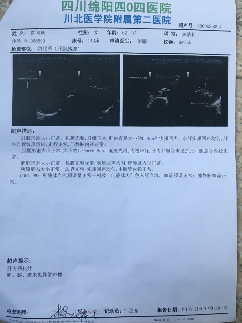 201011ccbh72k77c7cm2sh.jpg