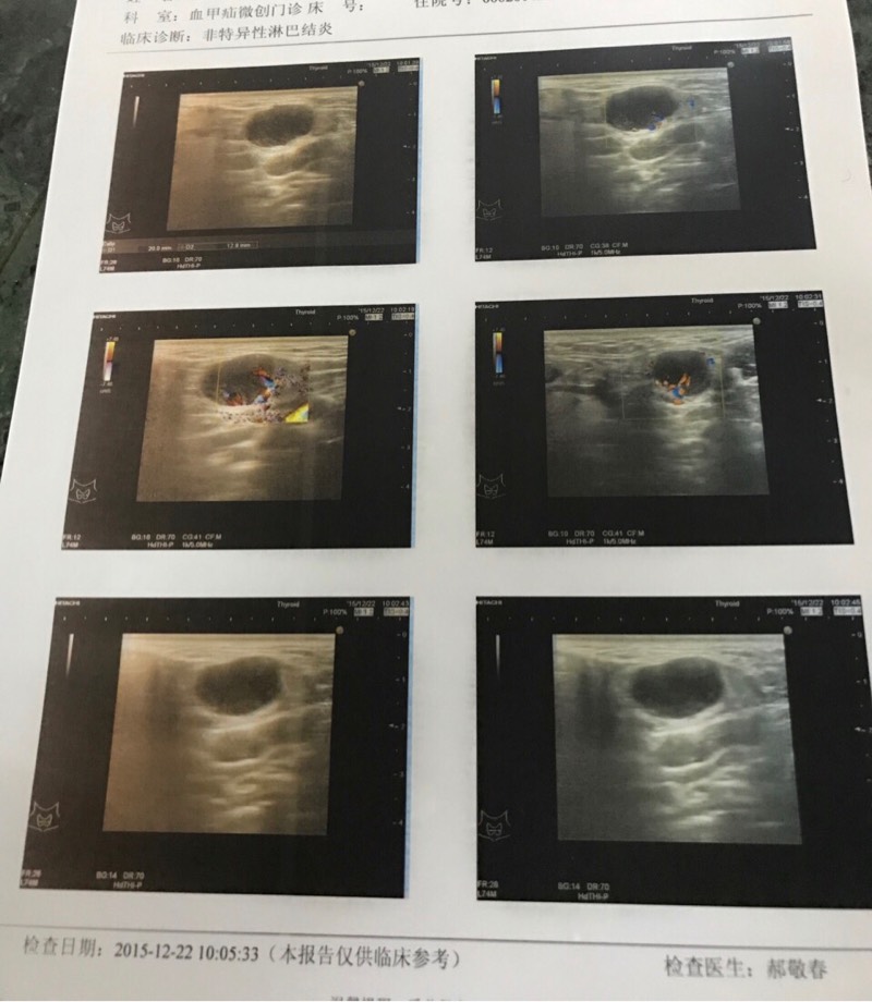 141618bw6gvw7wdnh6zd6v.jpg
