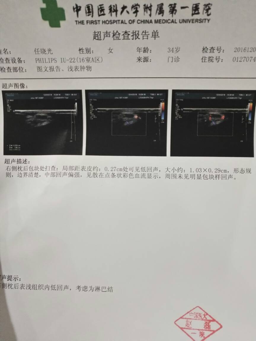 160950lt5mnujqn8jv55i8.jpg