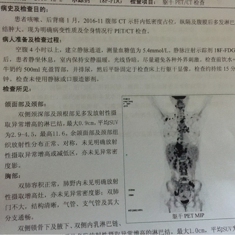 160238xmb69mq7dlmr277m.jpg