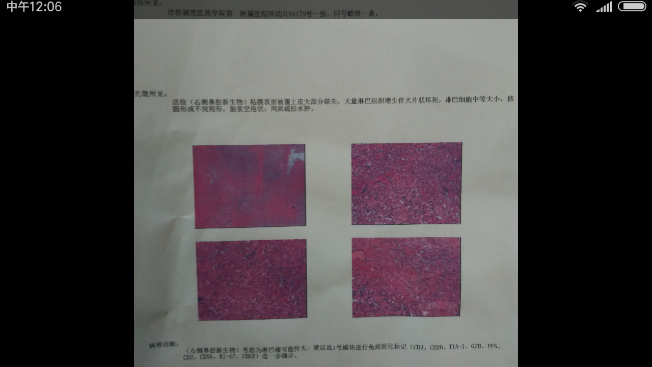 145530p86nj0jnisnaz86b.png