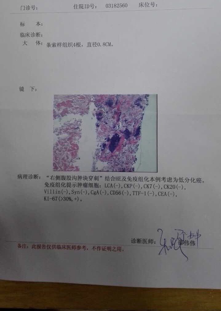120643ohplu8xub99898il.jpg