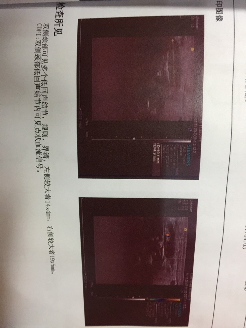 185645lwhb6fcc2sbc3h0j.jpg