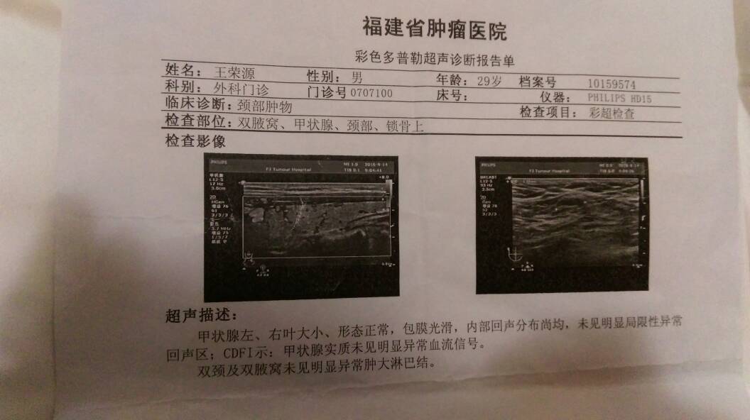 120238gkqxmcm9v9mxx4cb.jpg