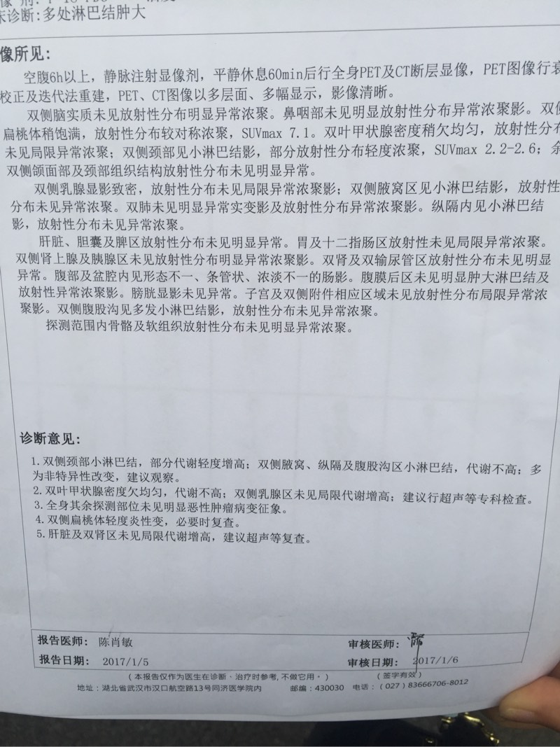 160303ack7zstq0cx383zy.jpg