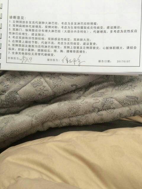 231724adbz56a151msbdgm.jpg