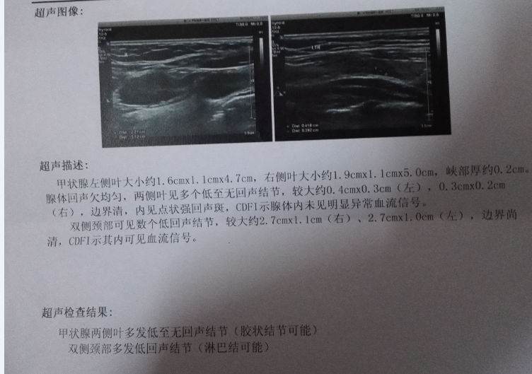 1月份B超