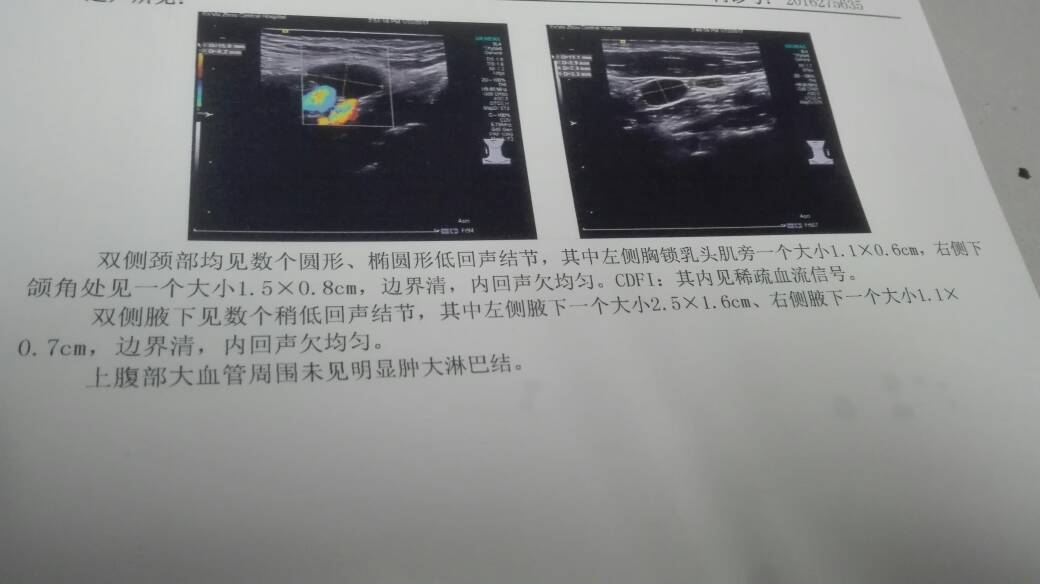 160741u8k702e217mzkw8m.jpg