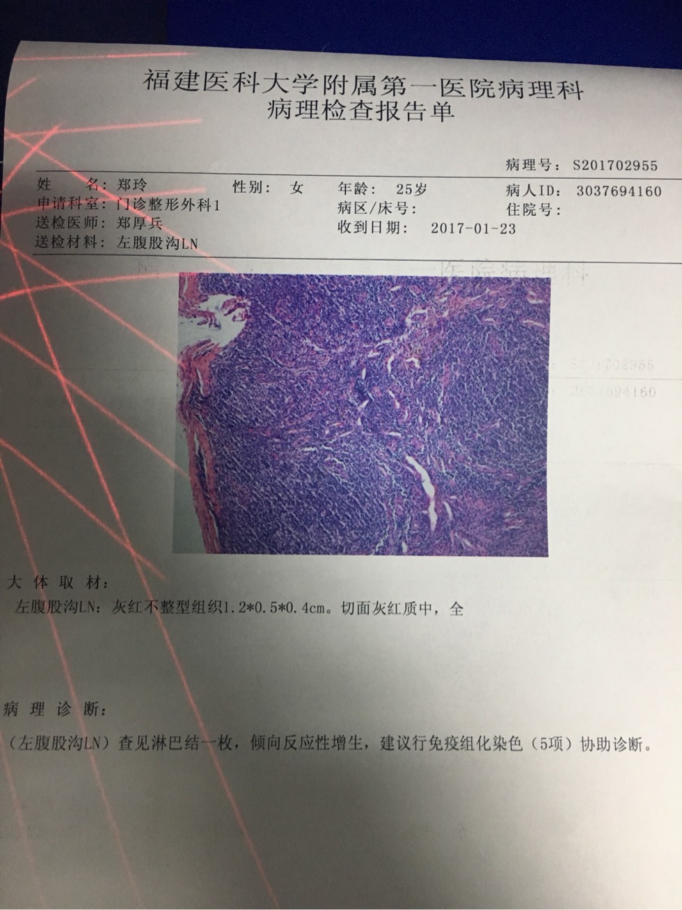 104715udcdzehdb1977kce.jpg