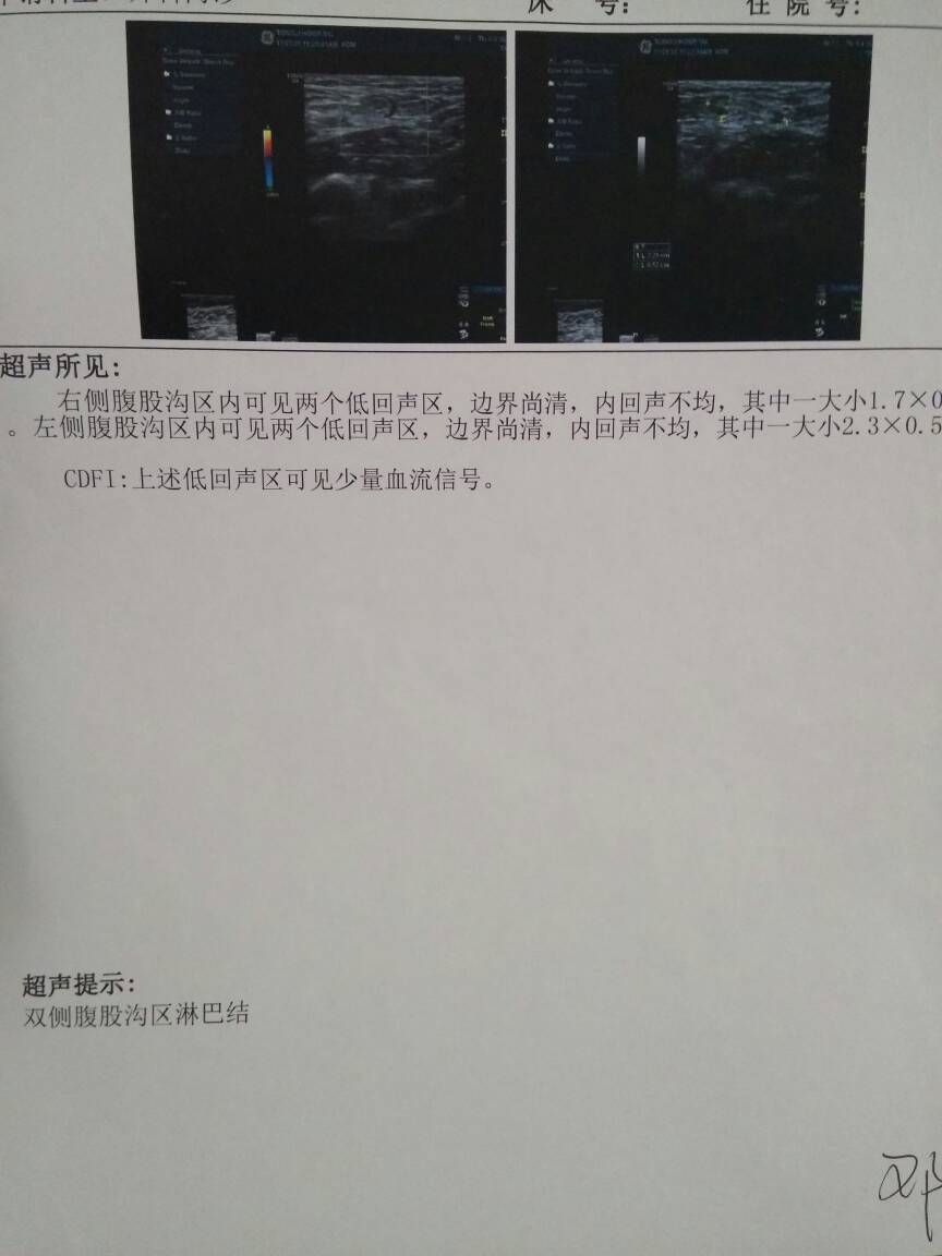 100936qwyttwutua64uw1h.jpg