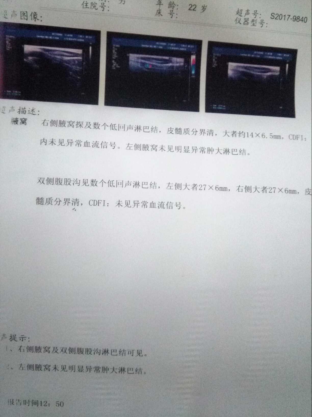 125008ofiuijivh0c3ddll.jpg