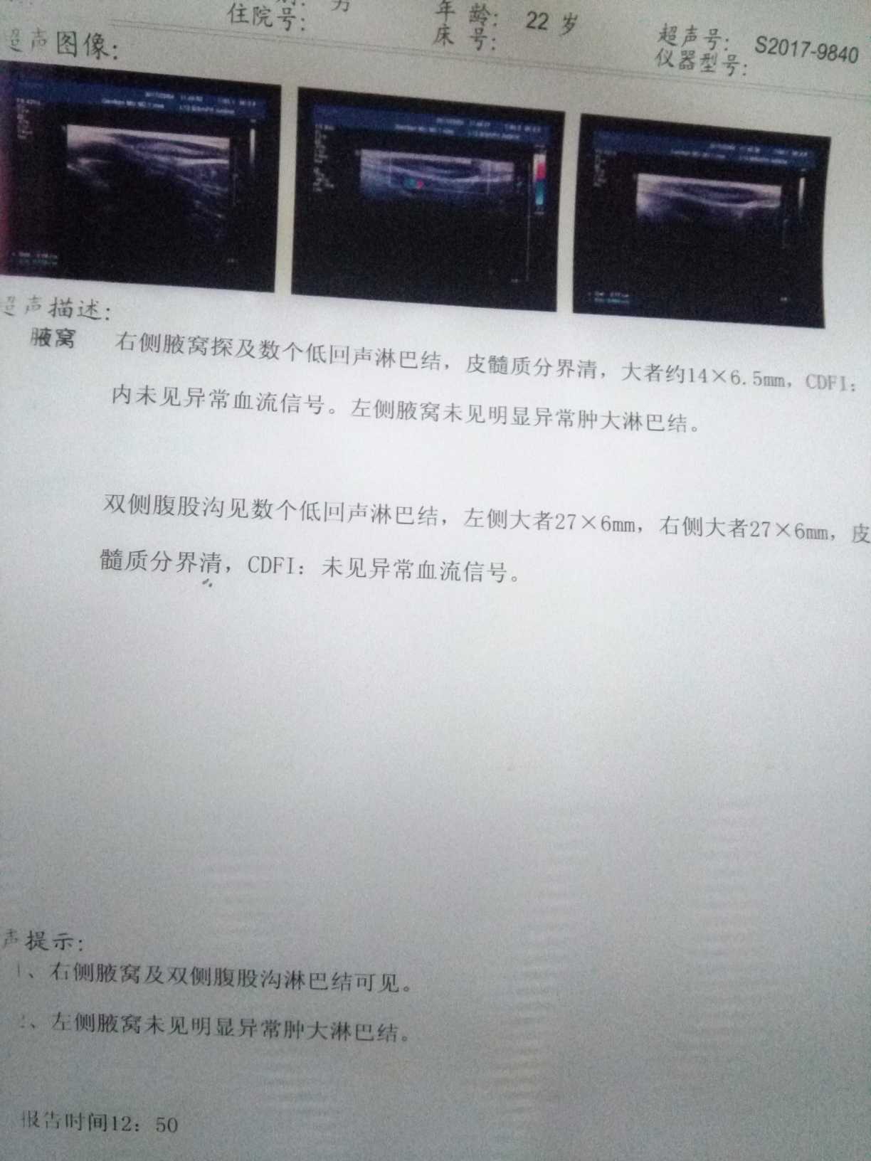 163032eg3akd34qkdq3ua3.jpg